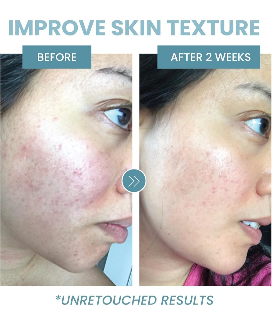 Eva collagen peptide complex serum