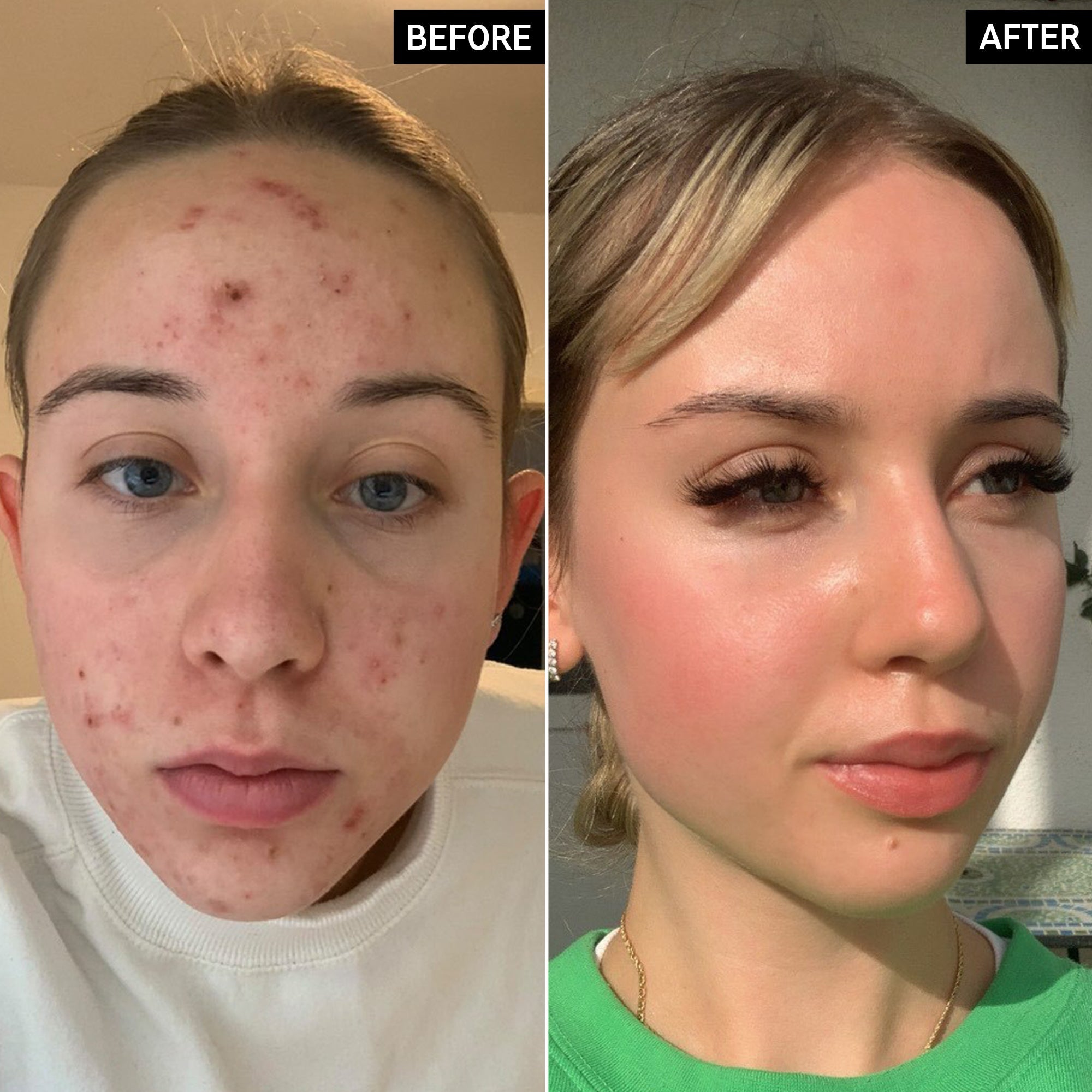 INKEY Tranexamic Acid Serum