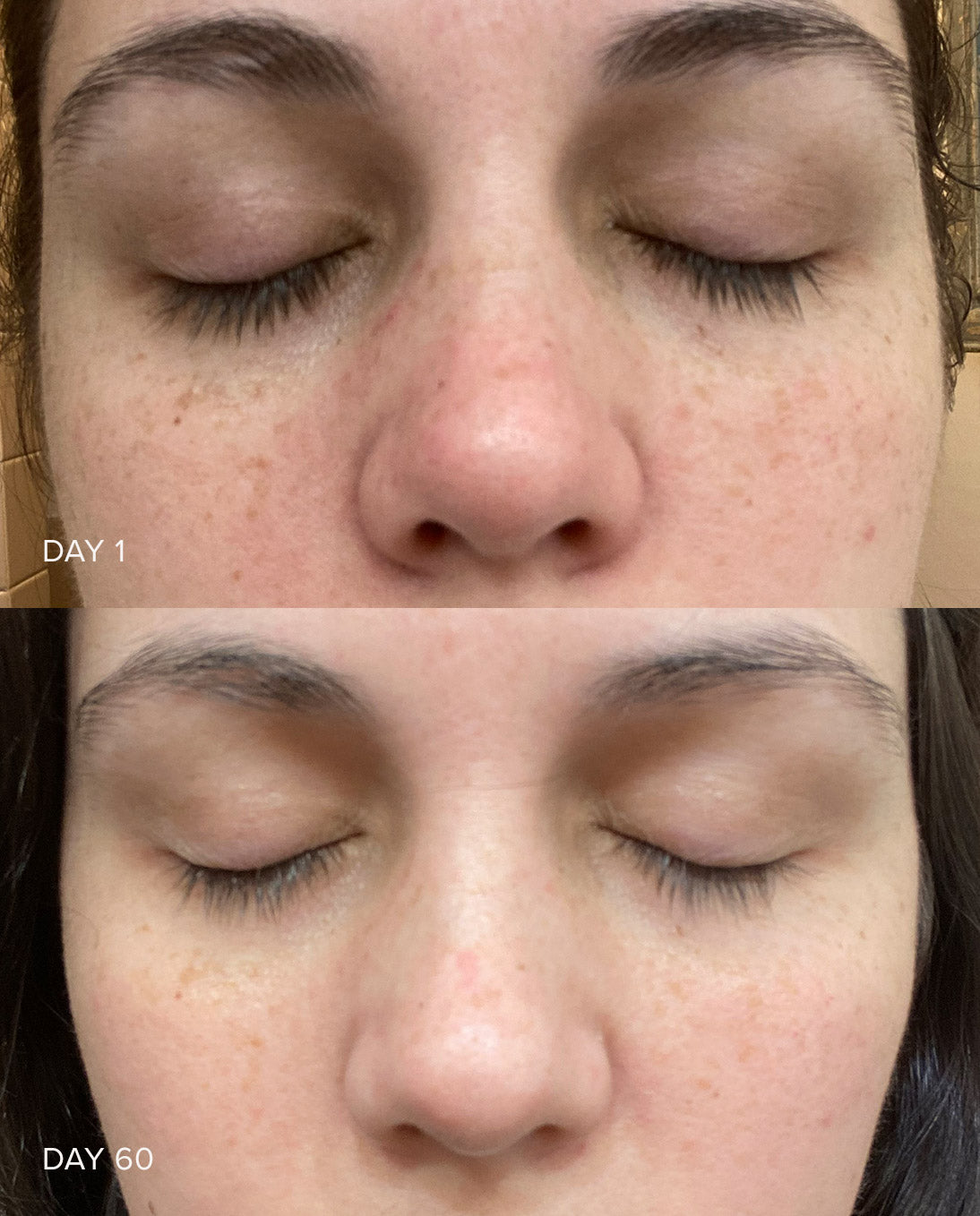 Eclat Glow Up Vitamin C Serum