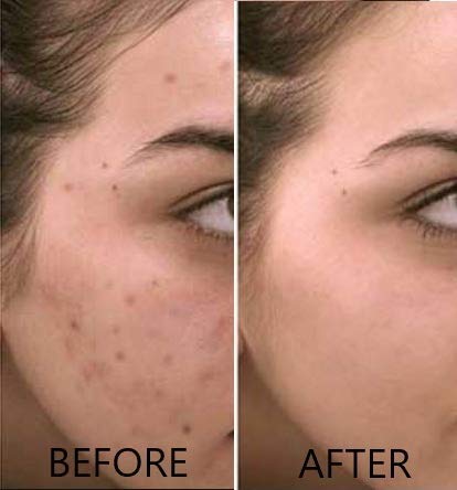 Eclat Glow Up Vitamin C Serum