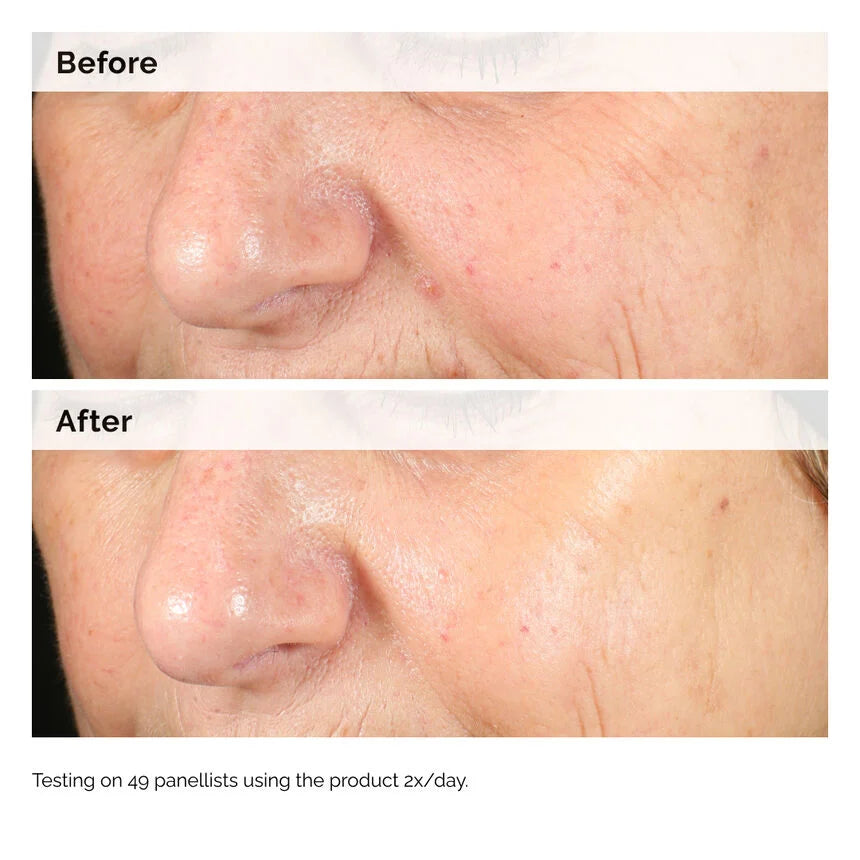 The Ordinary Alpha Arbutin (30ml)