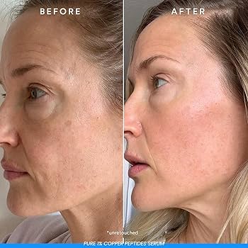 The Ordinary Multi-Peptide + Copper Peptides 1% Serum