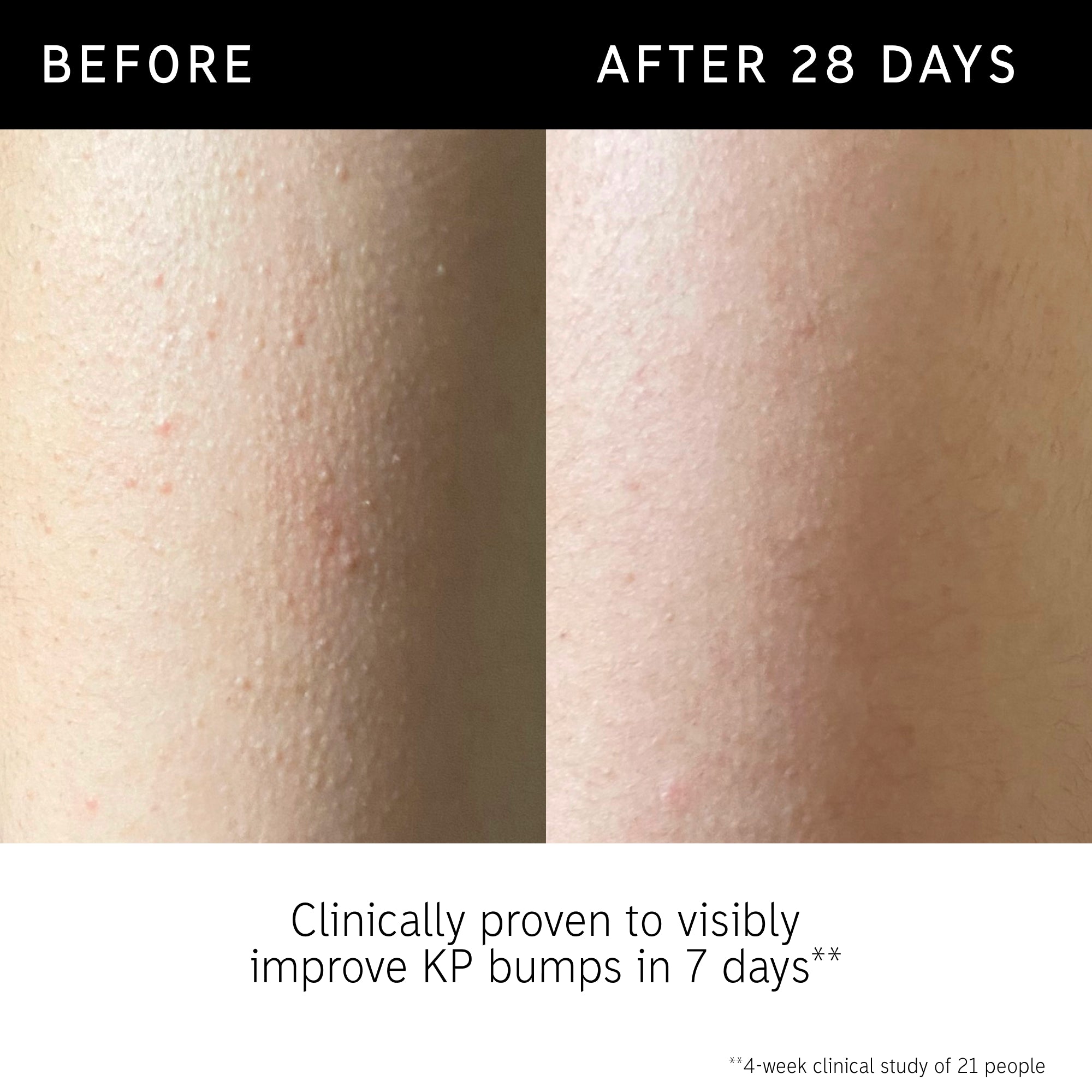 Inkey Glycolic Acid "BODY STICK"