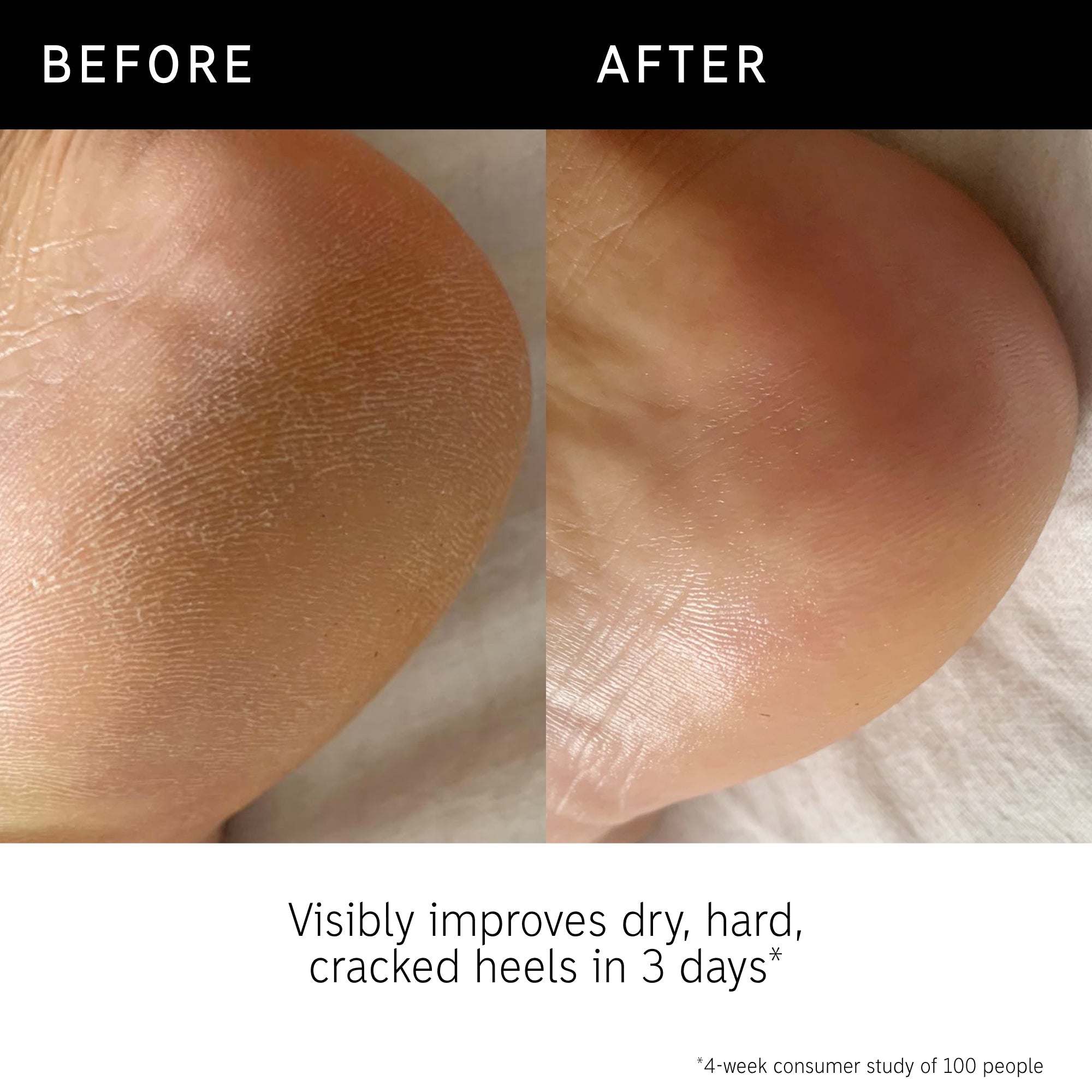 Inkey Glycolic Acid "BODY STICK"
