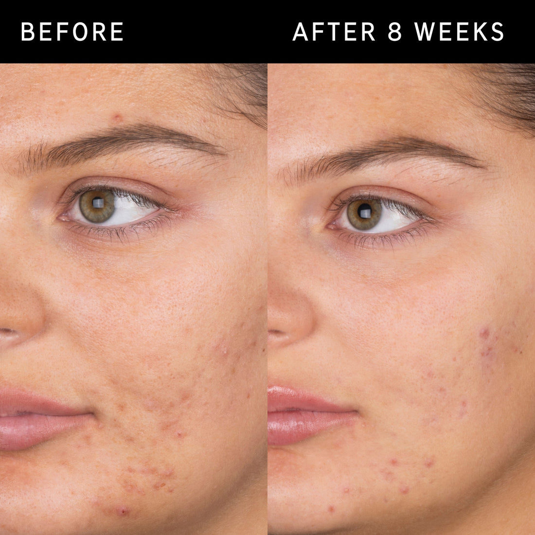 Inkey Salicylic  Acid Cleanser
