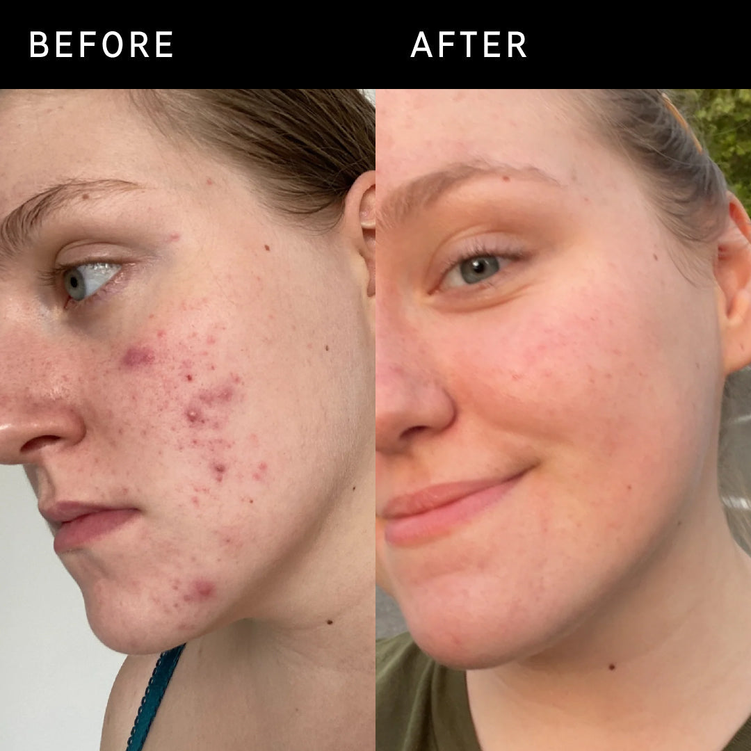 Inkey 15% Vitamin c +EGF Serum