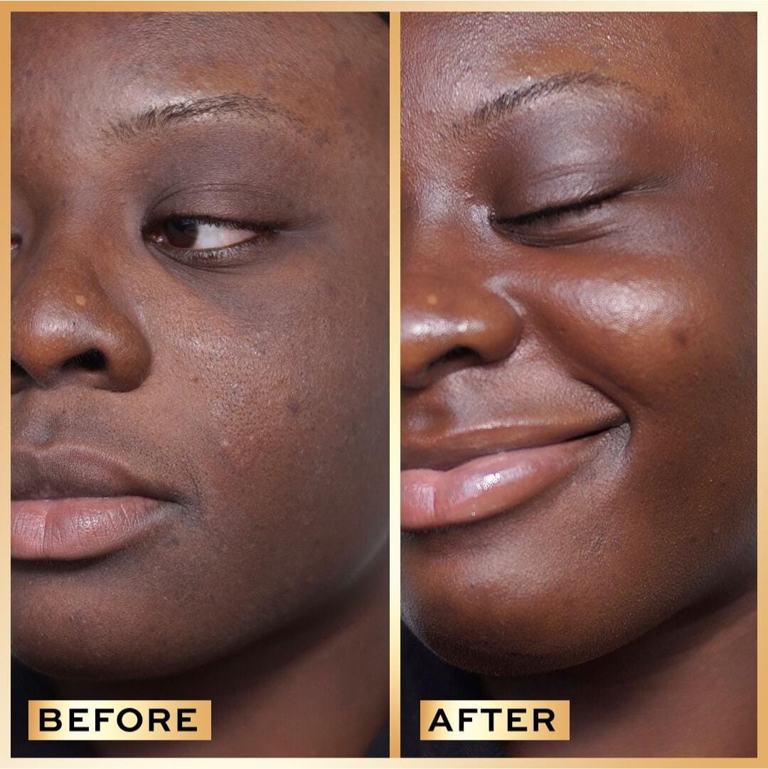 Revolution Pro Miracle Serum