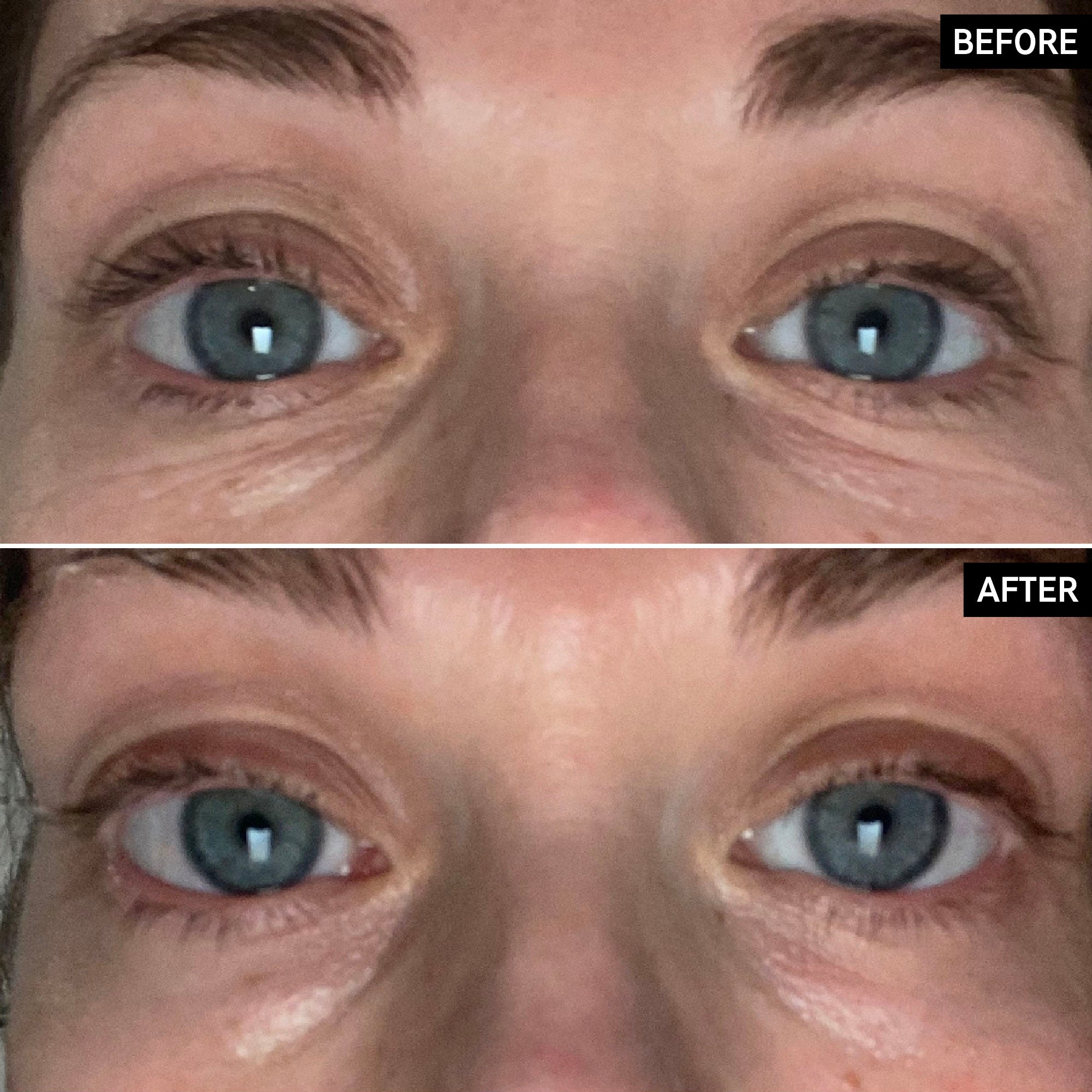Inkey Retinol Eye Cream