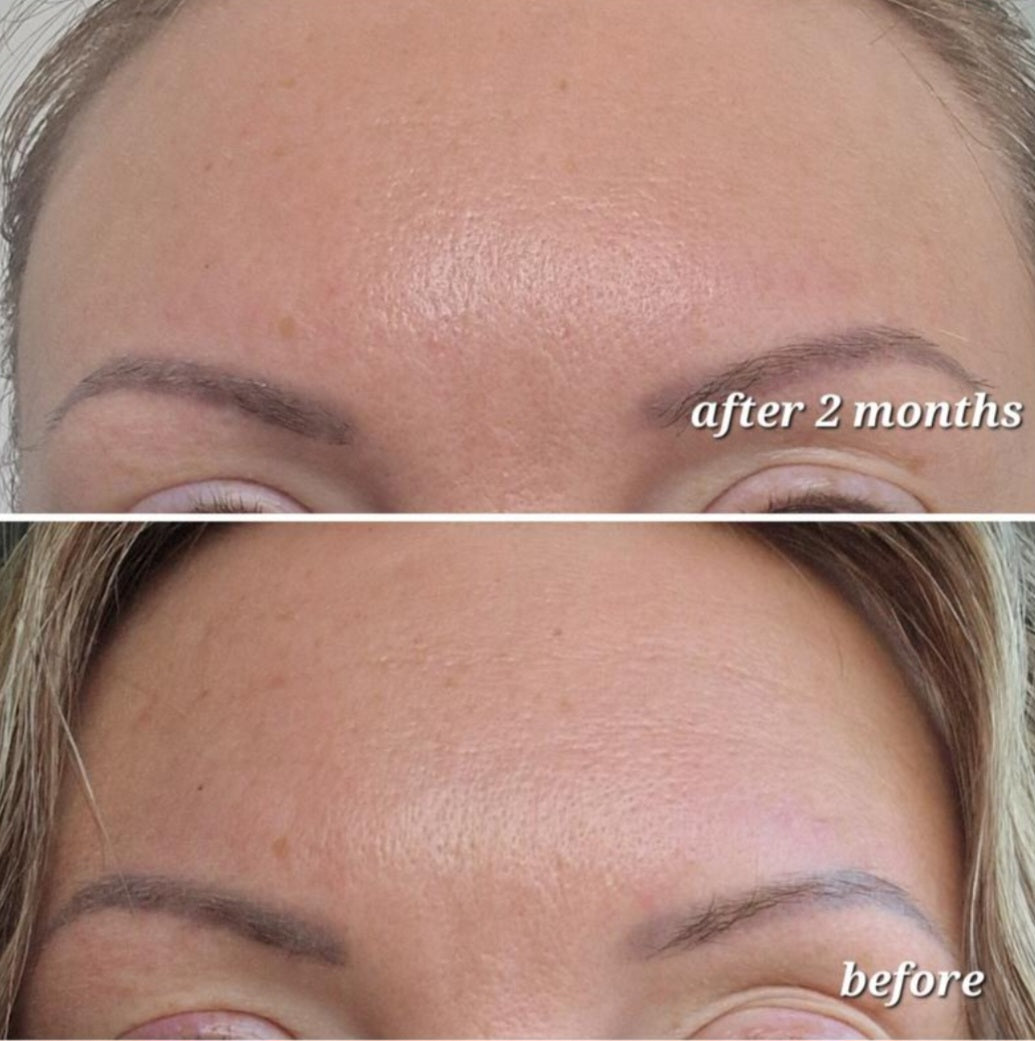 The Ordinary Matrixyl 10%+HA