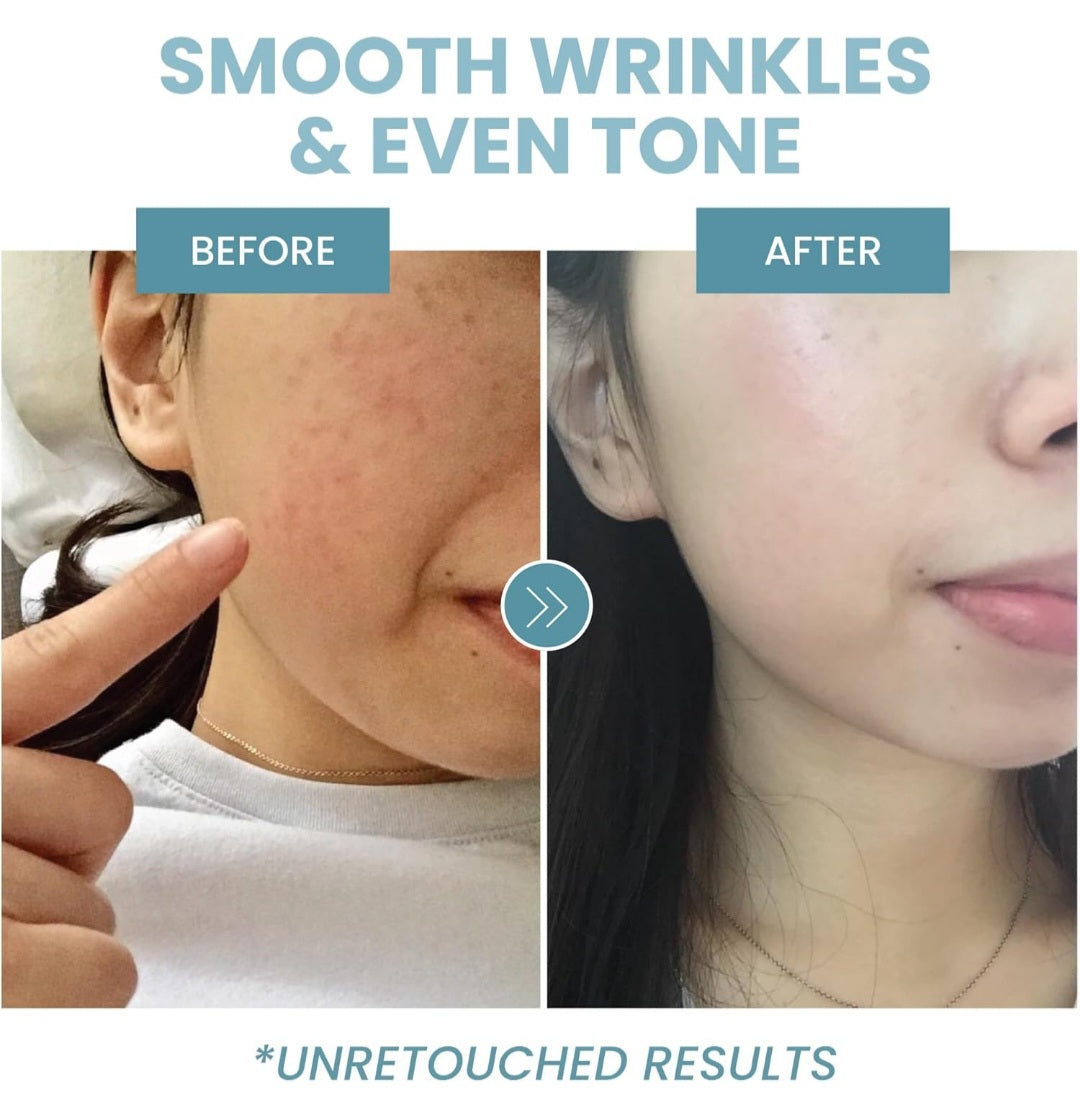 Eva collagen peptide complex serum
