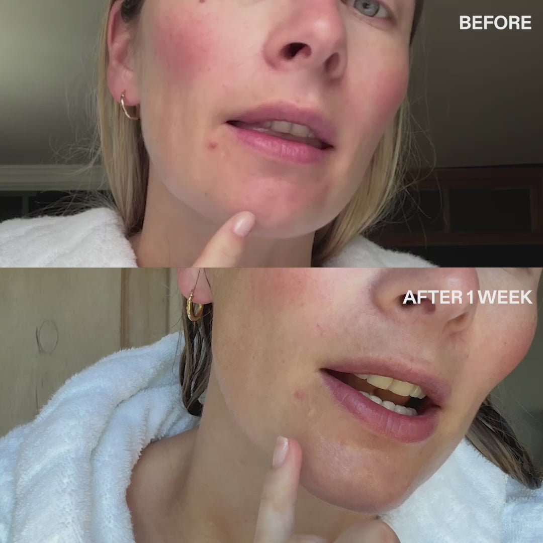 INKEY 360° Skin Clearing Serum