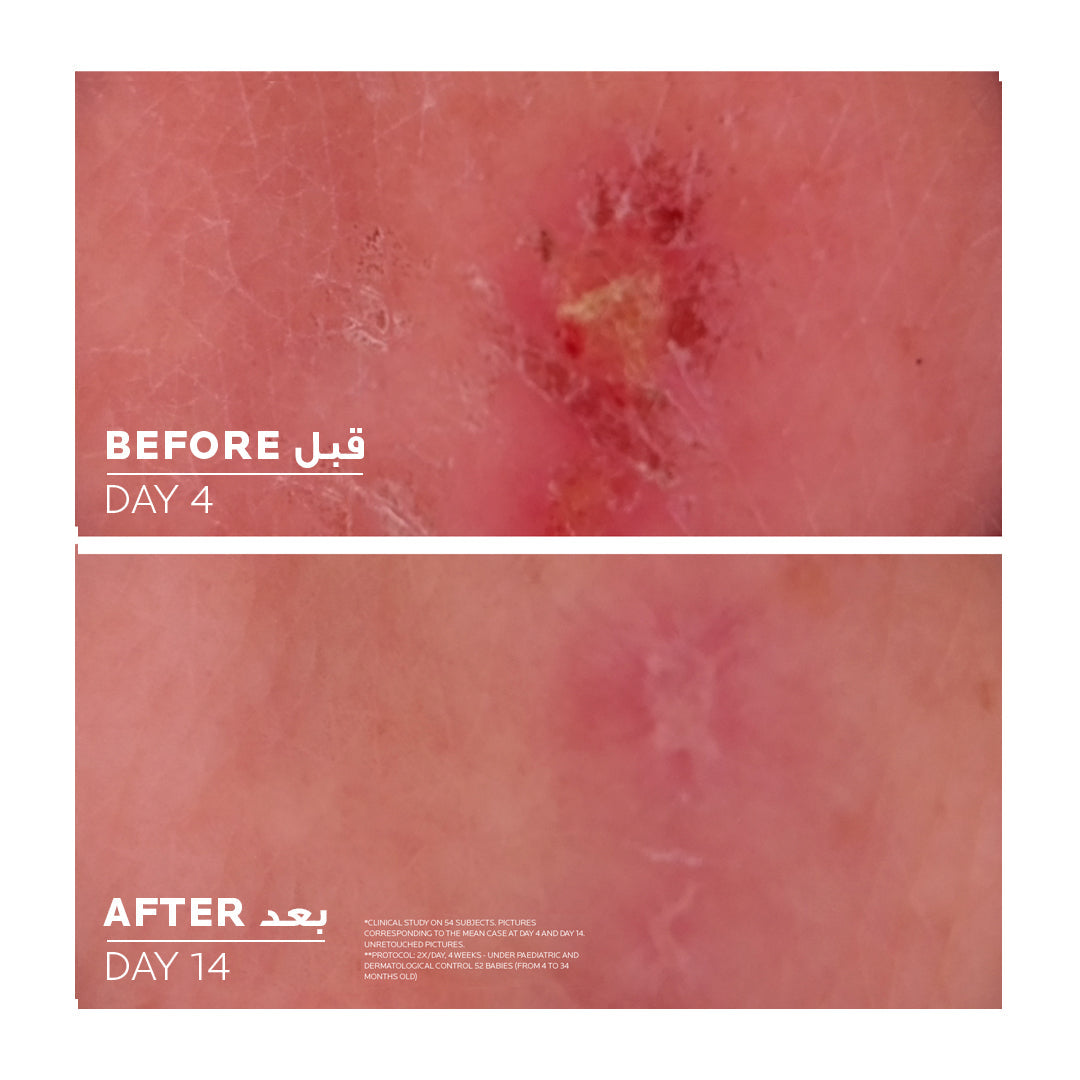 Cicaplast Baume B5+ Repairing Balm