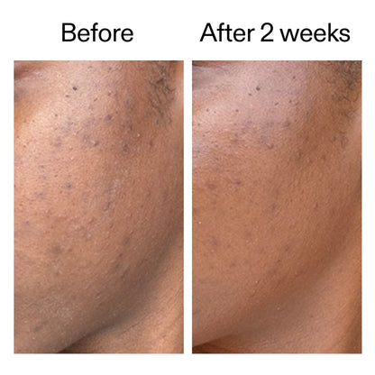 INKEY 360° Skin Clearing Serum