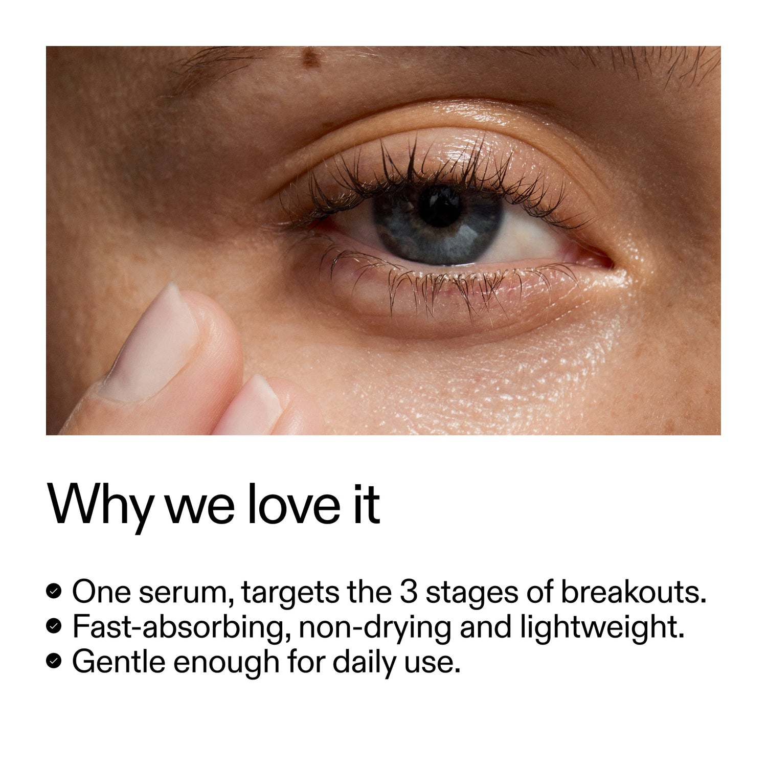 INKEY 360° Skin Clearing Serum