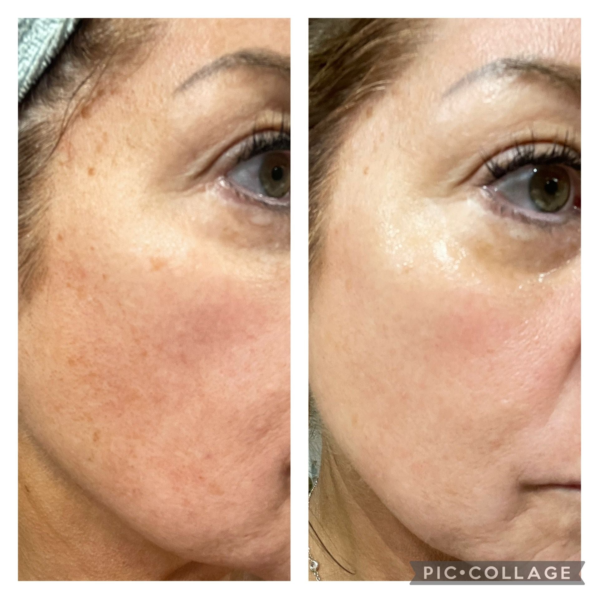 Inkey Q10 serum