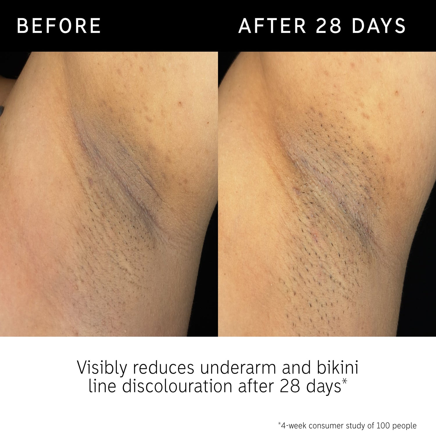 Inkey Glycolic Acid &quot;BODY STICK&quot;