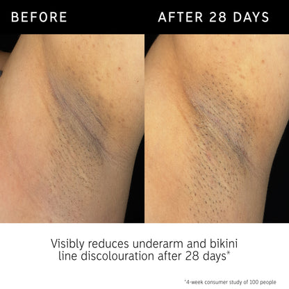 Inkey Glycolic Acid &quot;BODY STICK&quot;