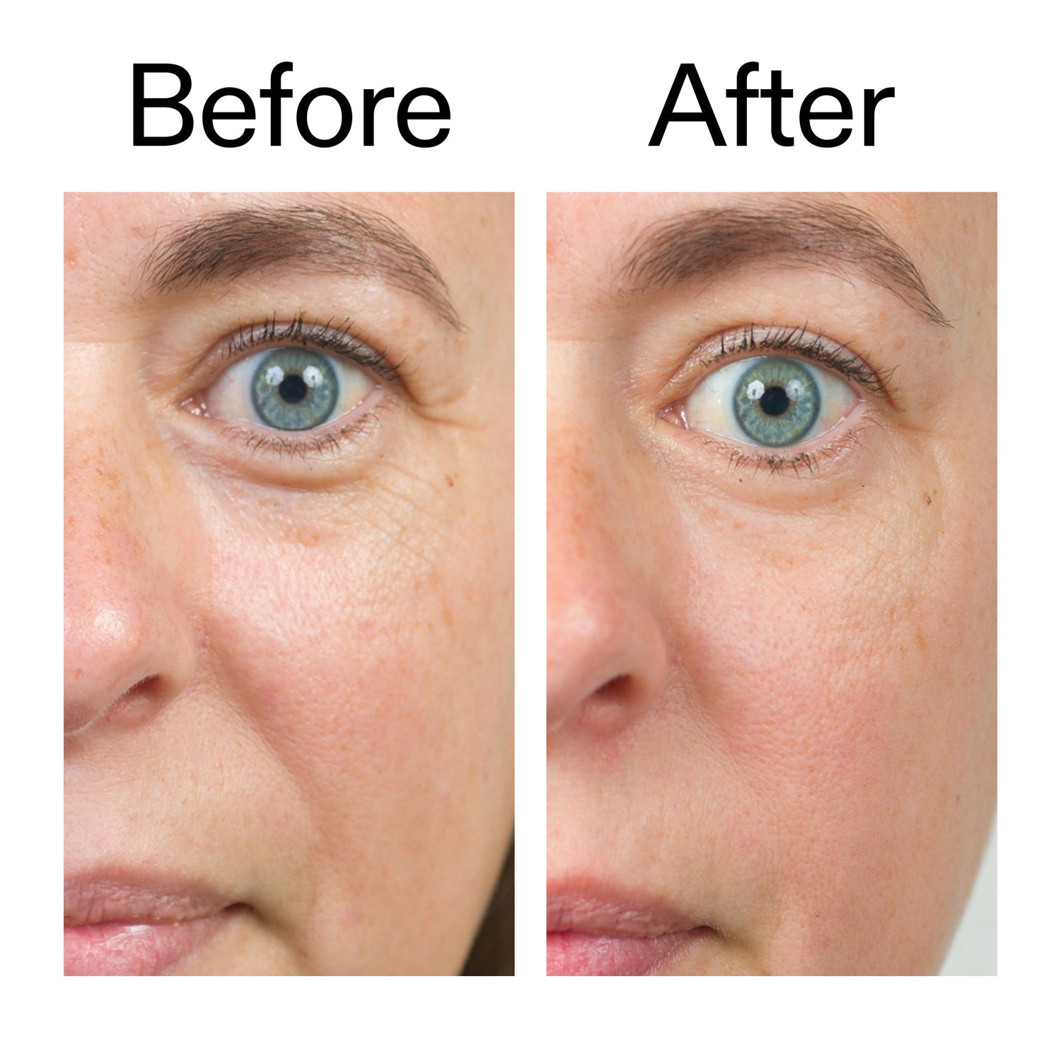 INKEY Bio-Active Ceramide Moisturiser